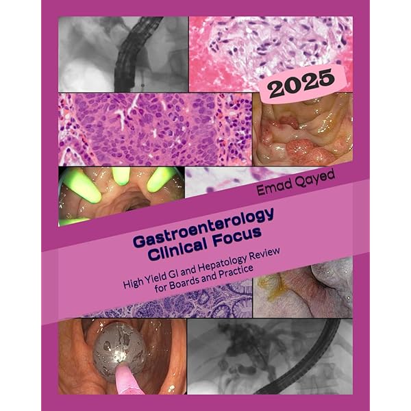 Gastroenterology Clinical Focus - Pocket edition: High yield GI